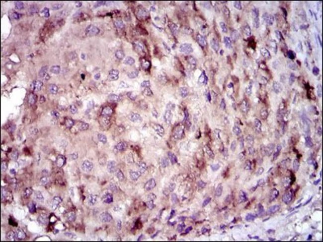 Anti-C-Reactive-Protein-CRP-Antibody-IHC