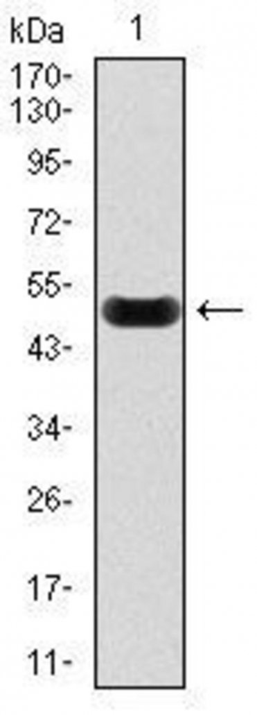 Anti-C-Reactive-Protein-CRP-Antibody-WB