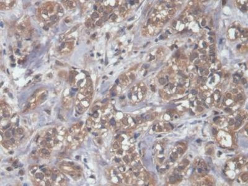 Anti-NT-ProBNP-Antibody-IHC-P