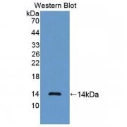 Anti-NT-ProBNP-Antibody-WB