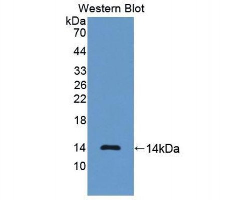 Anti-NT-ProBNP-Antibody-WB