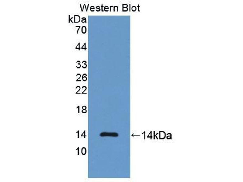 Anti-NT-ProBNP-Antibody-WB