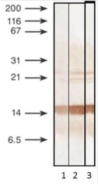 Anti-PCT-antibody-in-WB