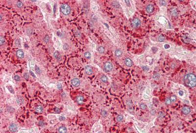 Anti-Serum-Amyloid-A-SAA-Antibody-IHC