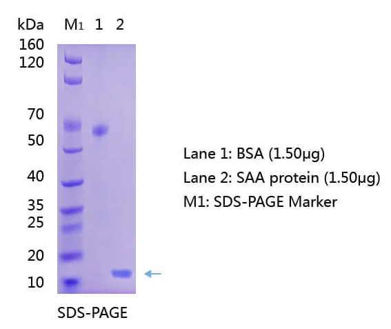 Anti-Serum-Amyloid-A-SAA-Antibody-WB