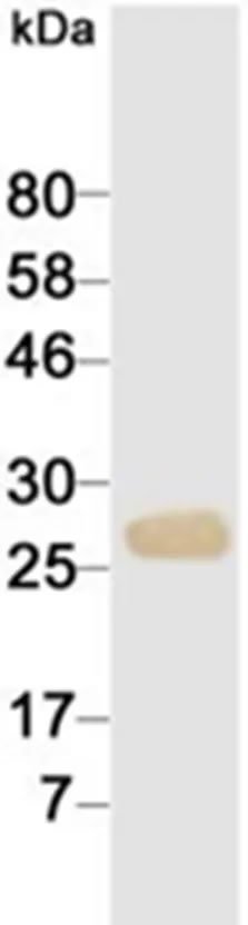 Anti-cTnI-Antibody-in-WB