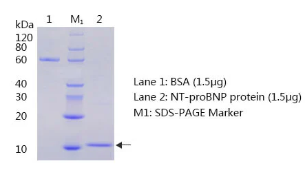 NT-proBNP-SDS-PAGE-and-WB