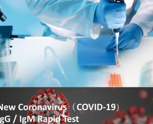 COVID-19-IgGIgM-Rapid-Test-Device