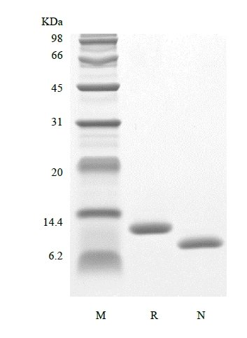 SDS-PAGE of Recombinant Human Interleukin-15