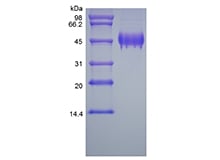 SDS-PAGE of Recombinant Human Pigment Epithelium-derived Factor