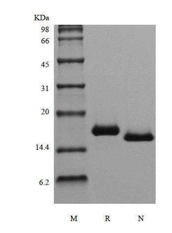SDS-PAGE of Recombinant Human Fms-related Tyrosine Kinase 3 Ligand