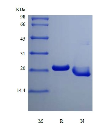 SDS-PAGE of Recombinant Human Oncostatin-M, 195a.a.