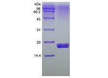 SDS-PAGE of Recombinant Human soluble Tumor Necrosis Factor-Related Apoptosis-inducing Ligand Receptor-2/TNFRSF10B