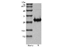 SDS-PAGE of Recombinant Human Fibroblast Growth Factor 17