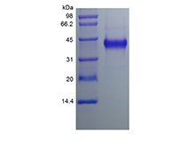 SDS-PAGE of Recombinant Human Cysteine-rich Angiogenic Inducer 61