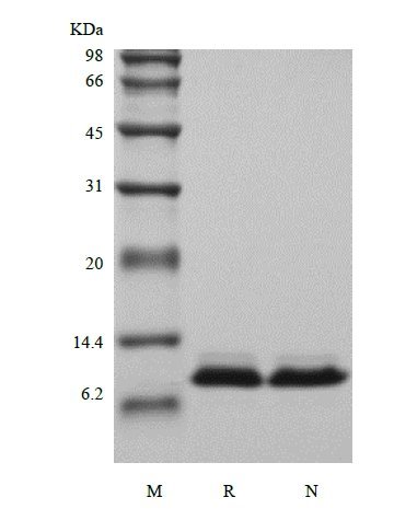 SDS-PAGE of Recombinant Human NT-pro-BNP