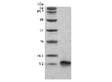 SDS-PAGE of Recombinant Human Beta-defensin 3