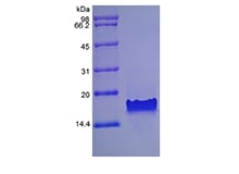 SDS-PAGE of Recombinant Murine Thymus Expressed Chemokine/CCL25