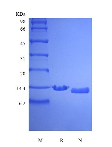 SDS-PAGE of Recombinant Human Parathyroid Hormone 1-84, 15N Stable Isotope Labeled