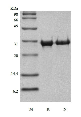 SDS-PAGE of Recombinant Human Matrix metalloproteinase-14