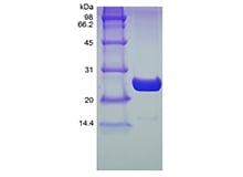 SDS-PAGE of Recombinant Human Ubiquitin-conjugating Enzyme E2 K, His