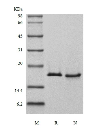 SDS-PAGE of Recombinant Human Ubiquitin-conjugating Enzyme E2 D3, His