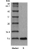 SDS-PAGE of Recombinant Human Epidermal Growth Factor GMP