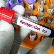 Monkeypox