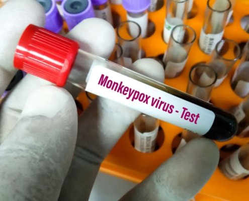 Monkeypox