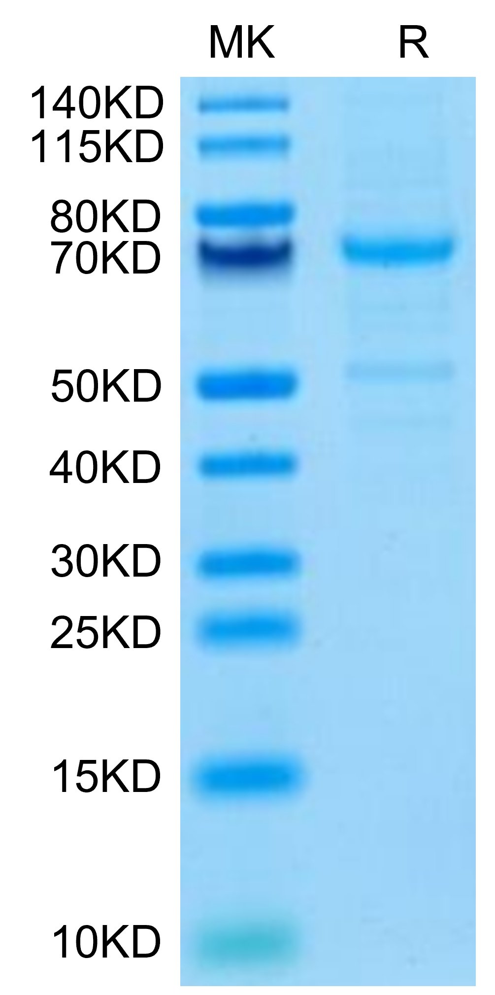 Mouse CDH3/Cadherin 3 Protein, Accession: P10287 - Jiangsu Watson Bio Ltd